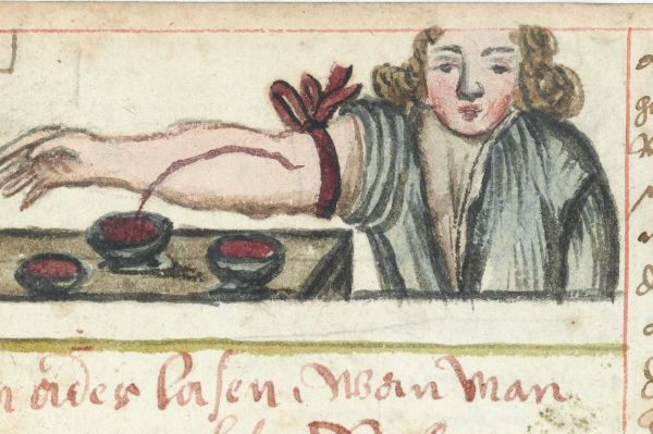 L0041074 WMS 990 Bloodletting Credit: Wellcome Library, London. Wellcome Images images@wellcome.ac.uk http://wellcomeimages.org Man wearing a tourniquet, letting blood into a bowl. Two other bowls already filled with blood sit nearby. ca. 1675 Arzneibuch. Compendium of popular medicine and surgery, receipts, etc., in German. Compiled for the use of a House of the Franciscan Order, probably in Austria, or South Germany. Published: - Copyrighted work available under Creative Commons Attribution only licence CC BY 4.0 http://creativecommons.org/licenses/by/4.0/