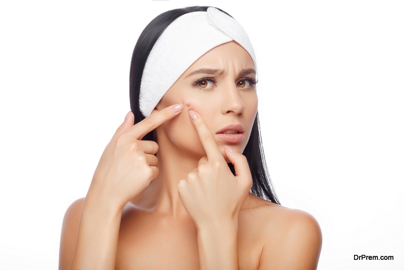 Tips for Treating Stubborn Acne